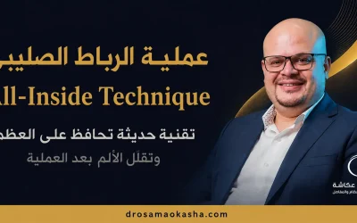 عملية الرباط الصليبي بتقنية All-Inside Technique