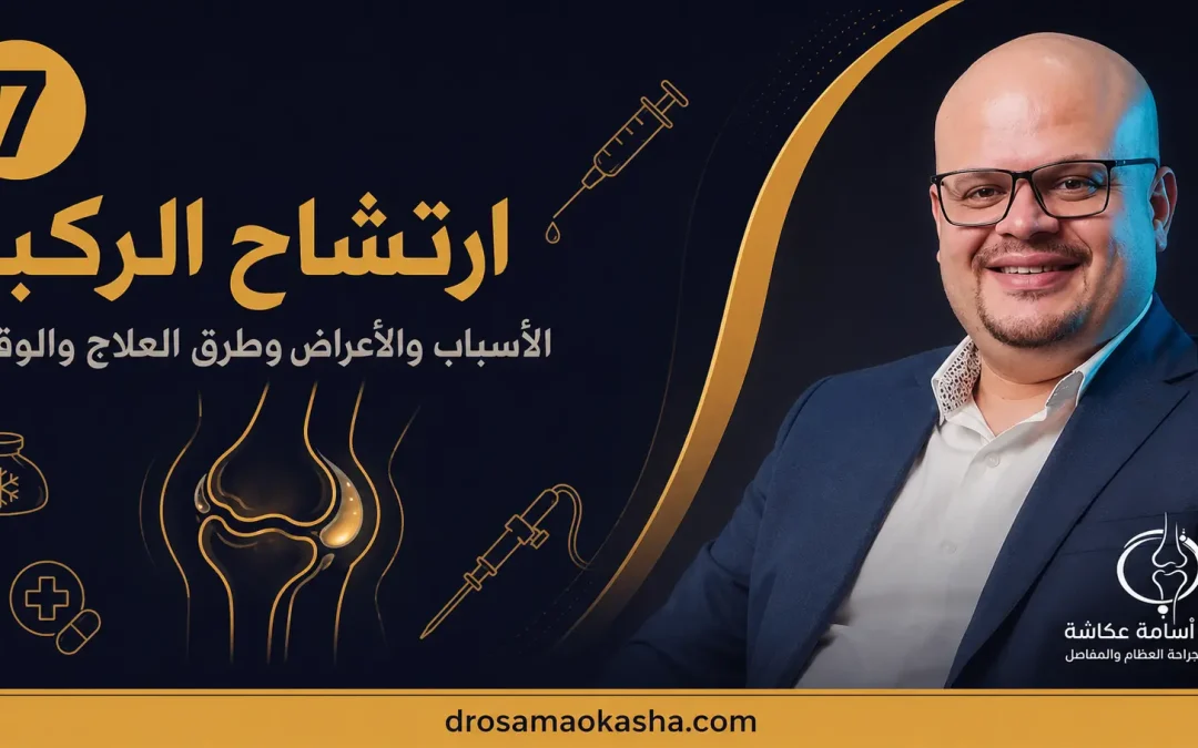 ارتشاح الركبة: الأسباب والأعراض وطرق العلاج والوقاية