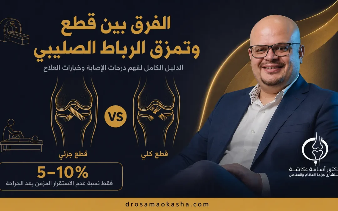 الفرق بين قطع وتمزق الرباط الصليبي: الدرجات والأعراض والعلاج 2026