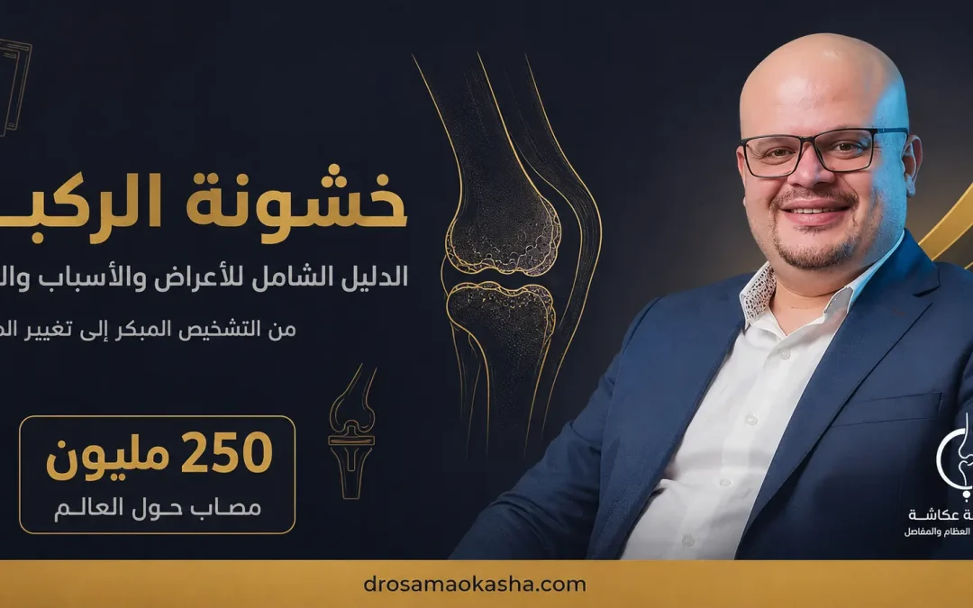 خشونة الركبة: الدليل الشامل للأعراض والأسباب والعلاج