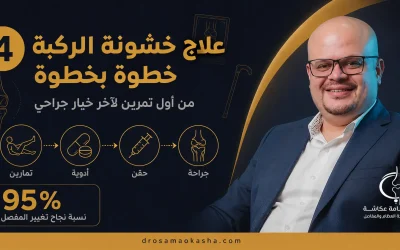 علاج خشونة الركبة خطوة بخطوة: من أول تمرين لآخر خيار جراحي