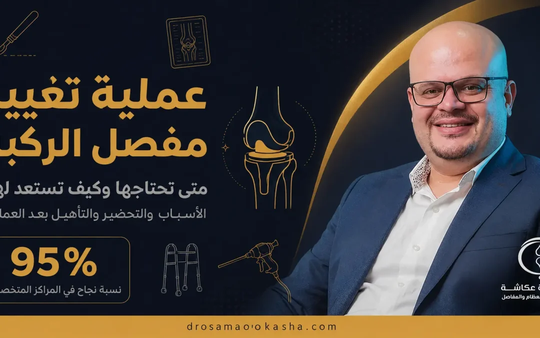 عملية تغيير مفصل الركبة: كل ما تحتاج معرفته قبل القرار