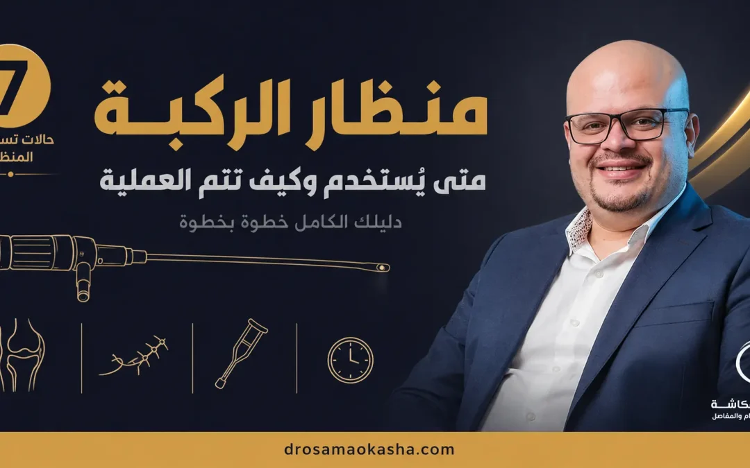 منظار الركبة: الخطوات الكاملة من التحضير إلى التعافي