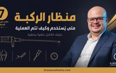 منظار الركبة: الخطوات الكاملة من التحضير إلى التعافي