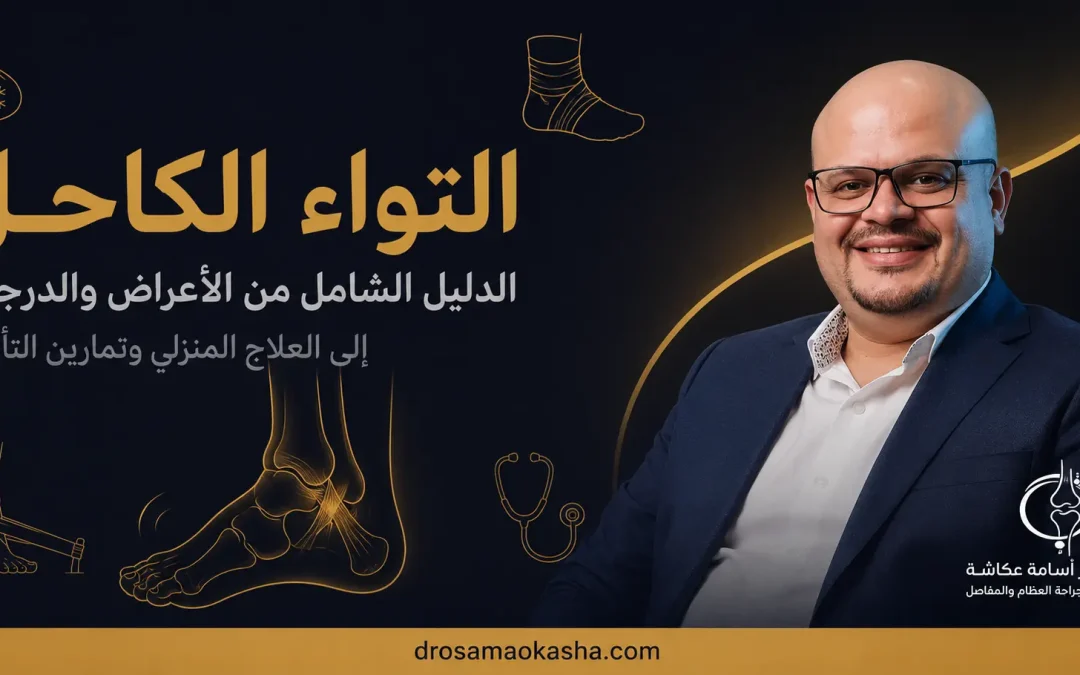 التواء الكاحل: الأعراض والأسباب والعلاج المنزلي ومدة الشفاء
