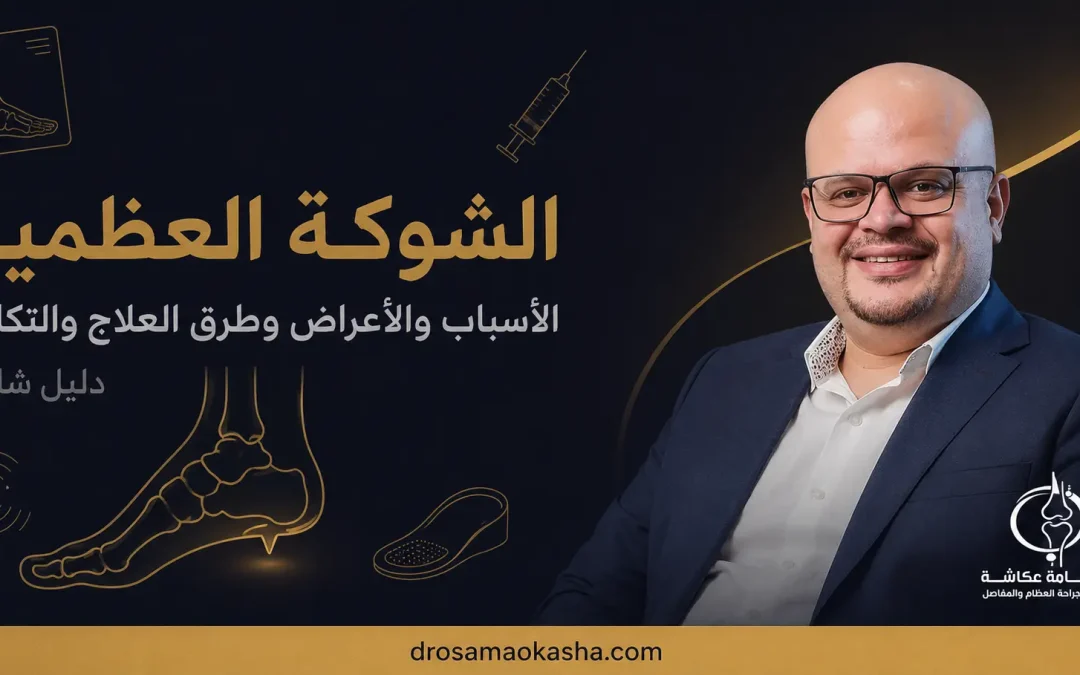 الشوكة العظمية في الكعب: الأسباب والأعراض وأفضل طرق العلاج بدون جراحة