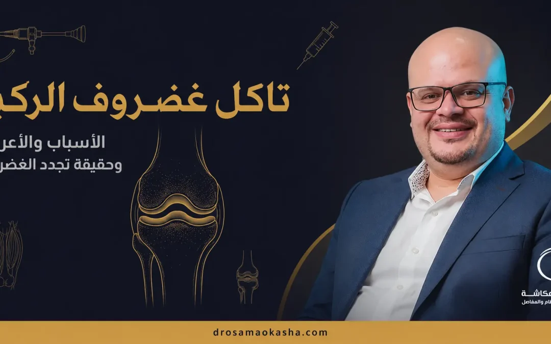 تآكل غضروف الركبة: الأسباب والأعراض وطرق العلاج وهل يتجدد الغضروف؟