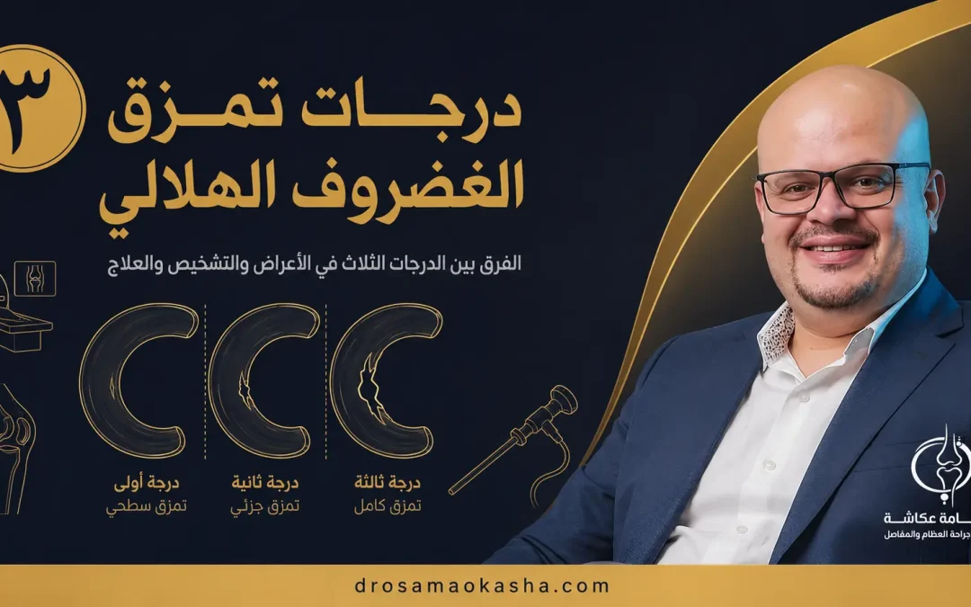 درجات تمزق الغضروف الهلالي: دليلك لفهم تقرير الرنين وعلاج كل درجة