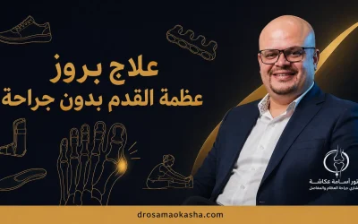 علاج بروز عظمة القدم بدون جراحة: الأسباب وأفضل الطرق التحفظية ومتى تحتاج الجراحة