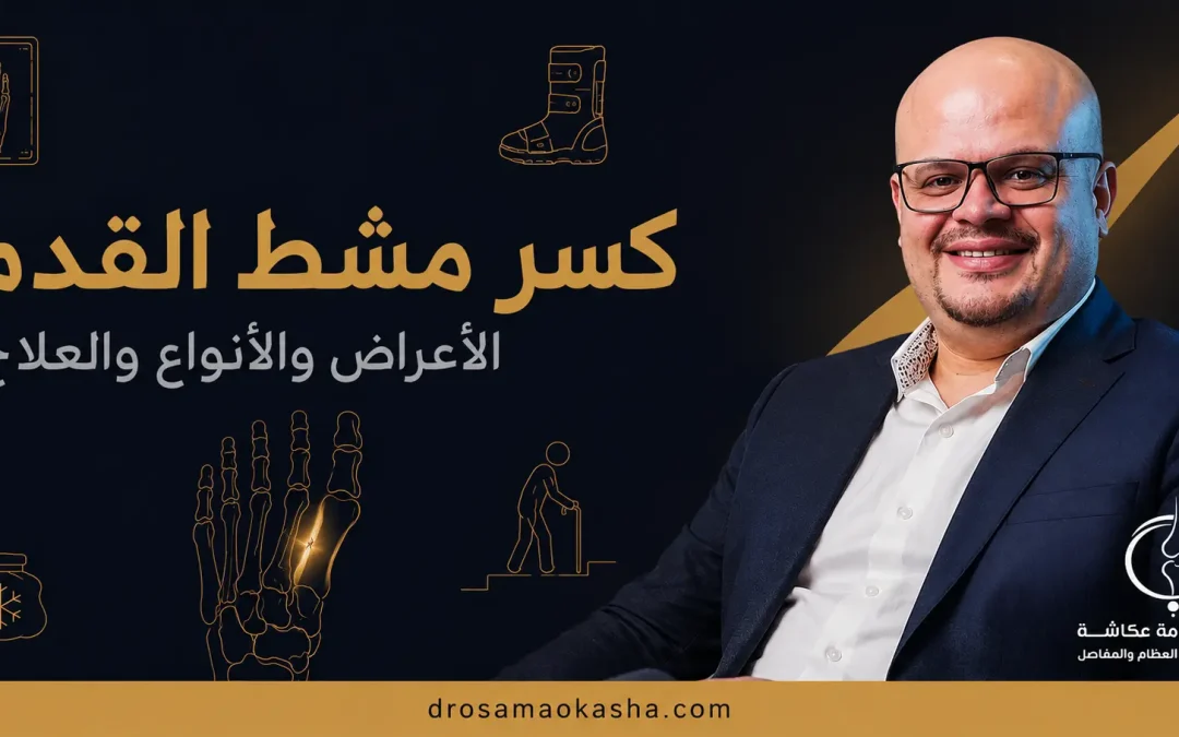 كسر مشط القدم: الأعراض والأنواع والعلاج ومدة الالتئام