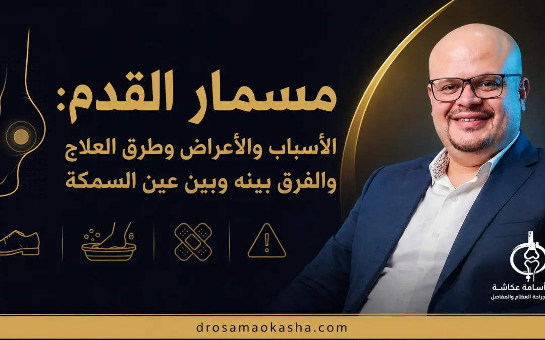 مسمار القدم: الأسباب والأنواع والأعراض وطرق العلاج المنزلي