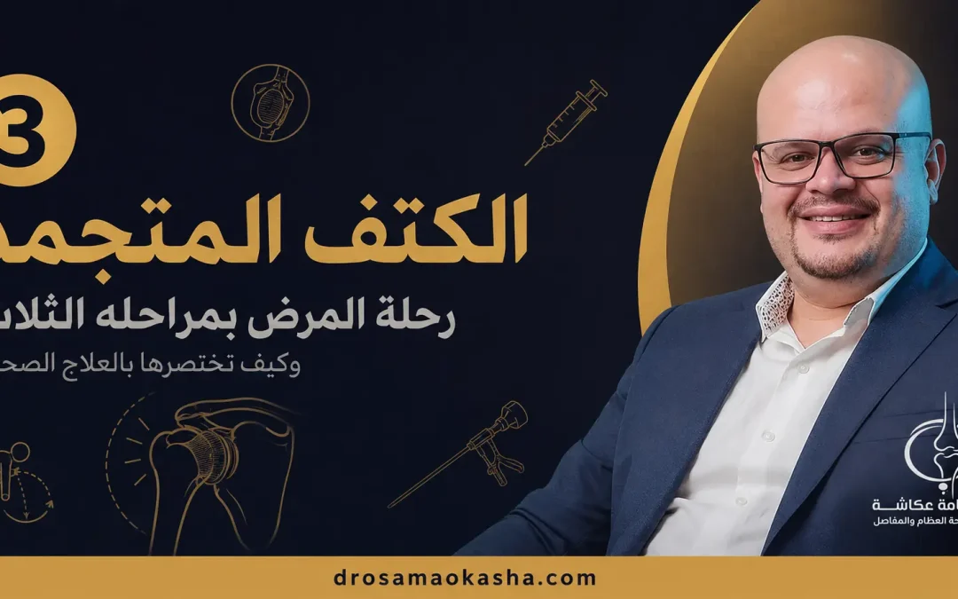 الكتف المتجمد: رحلة المرض بمراحله الثلاث وكيف تختصرها بالعلاج الصحيح