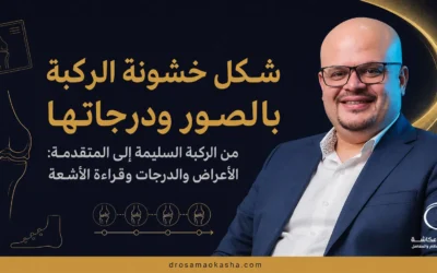 شكل خشونة الركبة بالصور ودرجاتها: من الركبة السليمة إلى المتقدمة