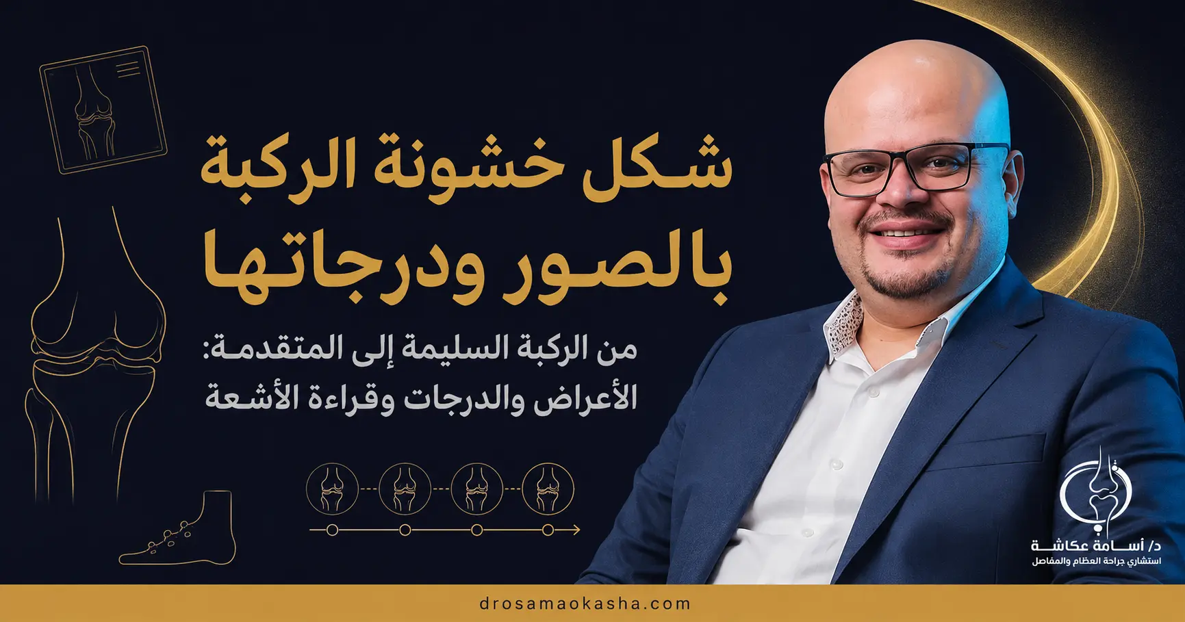 شكل خشونة الركبة بالصور