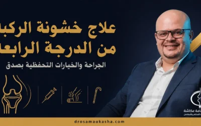 علاج خشونة الركبة من الدرجة الرابعة: الجراحة والخيارات التحفظية بصدق