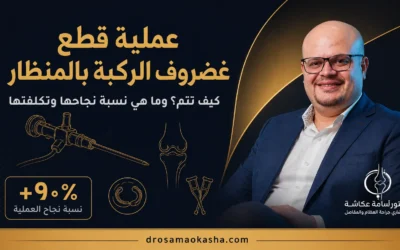 عملية قطع غضروف الركبة بالمنظار: كيف تتم ونسبة نجاحها وتكلفتها