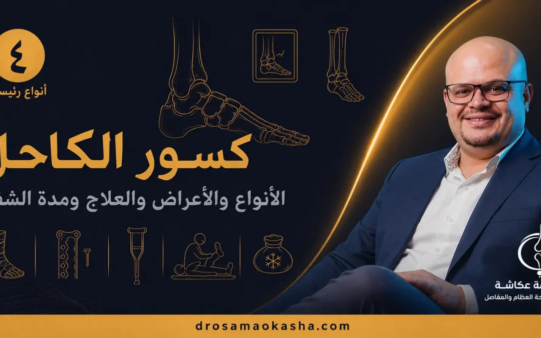 كسور الكاحل: الأنواع والأعراض والعلاج ومدة الشفاء
