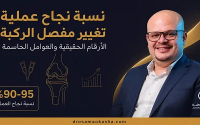 نسبة نجاح عملية تغيير مفصل الركبة: الأرقام الحقيقية والعوامل الحاسمة
