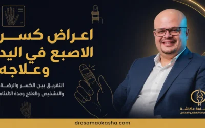 اعراض كسر الاصبع في اليد وعلاجه