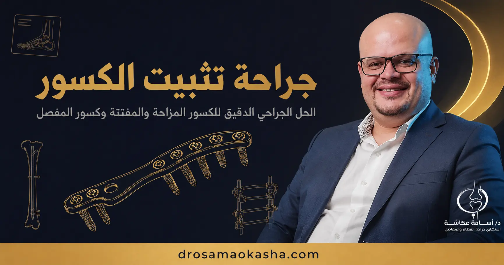 تثبيت الكسور
