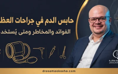 حابس الدم في جراحات العظام (التورنيكيه): الفوائد والمخاطر ومتى يُستخدم