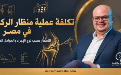 سعر عملية منظار الركبة في مصر 2026: التكلفة حسب نوع الإجراء والعوامل المؤثرة