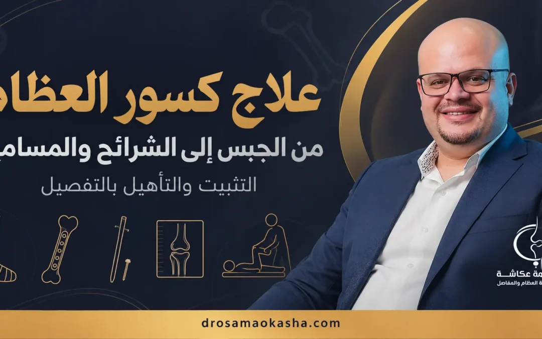 علاج كسور العظام: من الجبس إلى الشرائح والمسامير