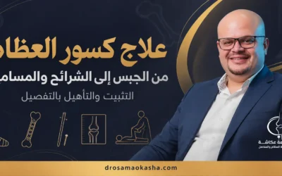 علاج كسور العظام: من الجبس إلى الشرائح والمسامير