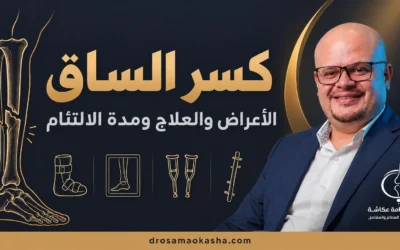 كسر الساق: الأعراض والعلاج ومدة الالتئام