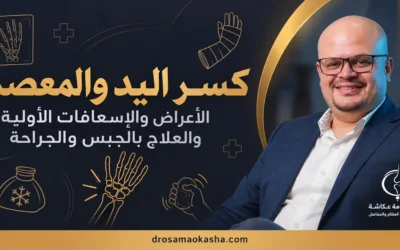 كسر اليد والمعصم: الأعراض والعلاج ومدة الشفاء