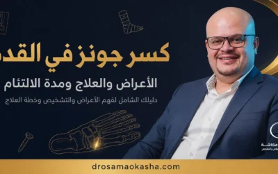 كسر جونز في القدم: الأعراض والعلاج ومدة الالتئام