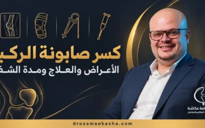 كسر صابونه الركبه: الأعراض والعلاج ومدة الشفاء
