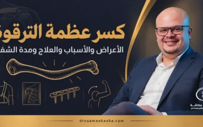 كسر عظمة الترقوة: الأعراض والعلاج ومدة الشفاء