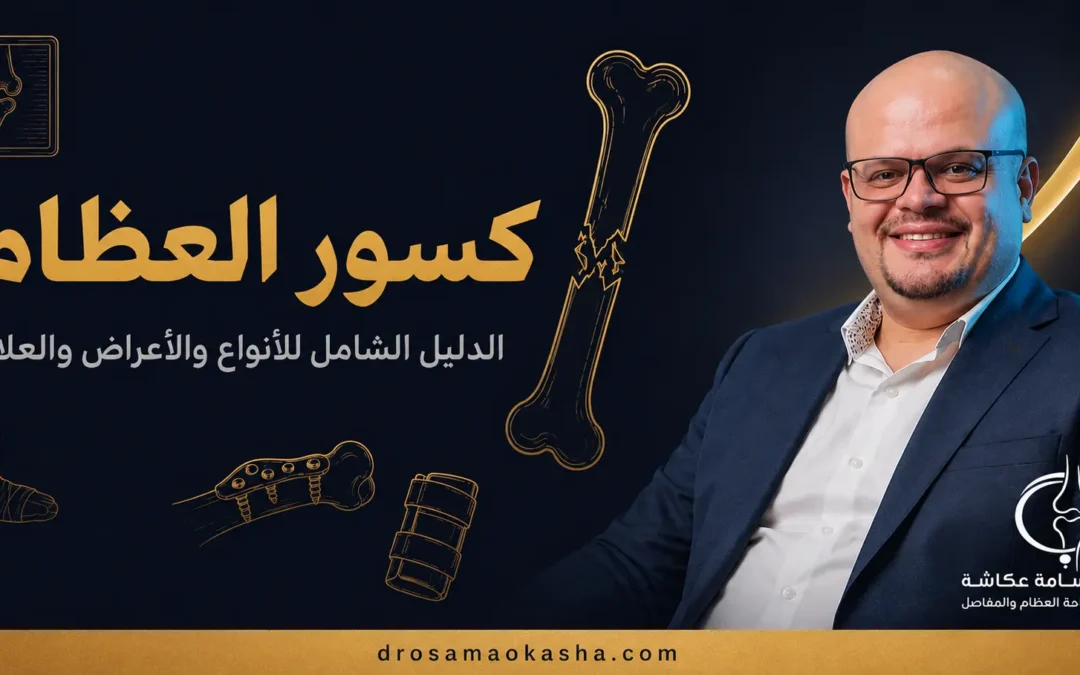 كسور العظام: الدليل الشامل للأنواع والأعراض والعلاج