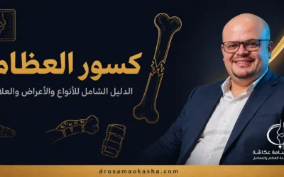 كسور العظام: الدليل الشامل للأنواع والأعراض والعلاج