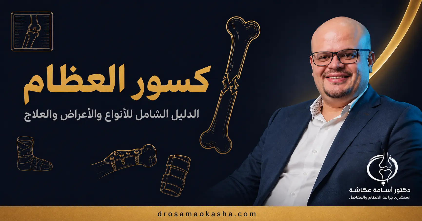 كسور العظام