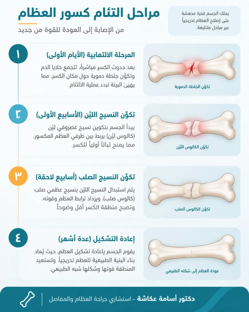 مراحل التئام كسور العظام ـ دكتور أسامة عكاشة