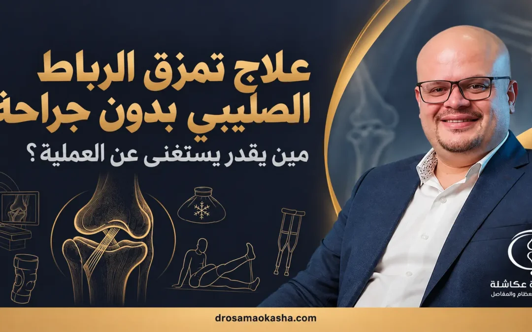 علاج تمزق الرباط الصليبي بدون جراحة: مين يقدر يستغنى عن العملية؟