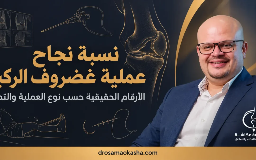 نسبة نجاح عملية غضروف الركبة: الأرقام الحقيقية حسب نوع العملية والتمزق