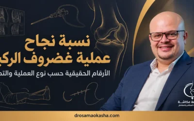 نسبة نجاح عملية غضروف الركبة: الأرقام الحقيقية حسب نوع العملية والتمزق