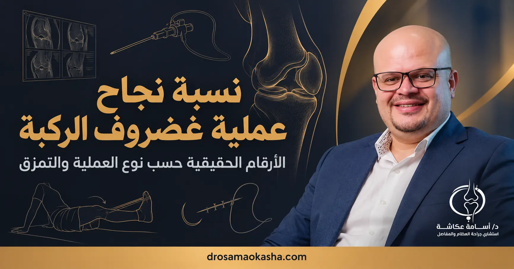 نسبة نجاح عملية غضروف الركبة نسبة نجاح عملية غضروف الركبة